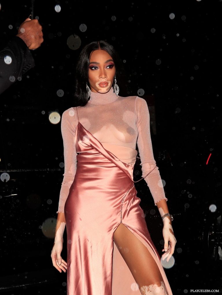 Read more about the article Model Winnie Harlow See Through And Hot Photos